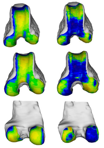 Biomechanics Abb. 37: Links, das aus den Mittelwerten aller 5 Hunde unter 15 kg rekonstruierte Objekt. Rechts, Darstellung der Standardabweichung der 5 Femora. (von oben nach unten: Ansicht von kranial, kraniodistal und kaudal)