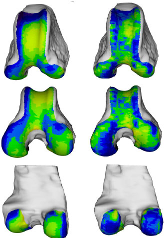 Biomechanics Abb. 38: Links, das aus den Mittelwerten aller 8 männlichen Hunde rekonstruierte Objekt. Rechts, Darstellung der Standardabweichung der 8 Femora. (von oben nach unten: Ansicht von kranial, kraniodistal und kaudal)