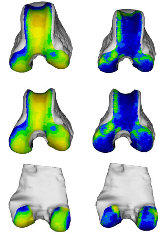 Biomechanics Abb. 39: Links, das aus den Mittelwerten 11 weiblichen Hunde rekonstruierte Objekt. Rechts, Darstellung der Standardabweichung der 11 Femora. (von oben nach unten: Ansicht von kranial, kraniodistal und kaudal)