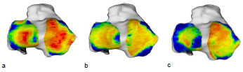 Biomechanics Abb. 40: Vergleichende Darstellung der individuellen Knochendichteverteilung der Facies articularis tibiae von drei verschiedenen Hunden. a: rechte Tibia eines Mischlings, männlich, 21 kg, Altersgruppe III (Hd 28) b: linke Tibia eines DSH, männlich, 25 kg, Altersgruppe II (Hd DSH) c: linke Tibia eines Airdale Terriers, männlich, 26,5 kg, Altersgruppe III (Hd 39). Ansicht der Tibiagelenkfläche.