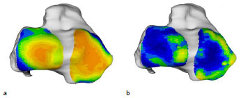 Biomechanics Abb. 41: Mittelwert (a) aller 20 Tibiae und Standardabweichung (b). Ansicht der Tibiagelenkfläche.