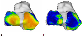 Biomechanics Abb. 42: Mittelwert aller 12 Tibiae über 15 kg und Standardabweichung. Ansicht der Tibiagelenkfläche.