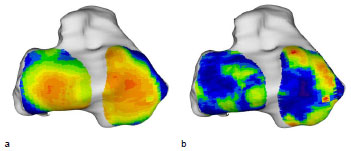 Biomechanics Abb. 43: Mittelwert (a) aller 6 Tibiae unter 15 kg und Standardabweichung (b). Ansicht der Tibiagelenkfläche.