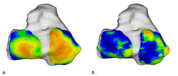 Biomechanics Abb. 44: Mittelwert (a) aller 9 männlichen Tibiae und Standardabweichung (b). Ansicht der Tibiagelenkfläche.