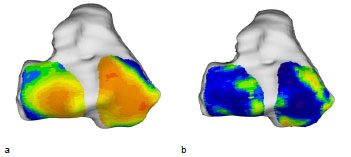 Biomechanics Abb. 45: Mittelwert (a) aller 11 weiblichen Tibiae und Standardabweichung (b). Ansicht der Tibiagelenkfläche.