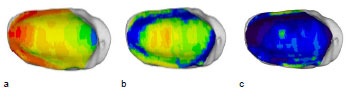 Biomechanics Abb. 46: Vergleichende Darstellung der auf das, Normgelenk projizierten individuellen Knochendichteverteilung der Facies articularis tibiae von drei verschiedenen Hunden. a: rechte Tibia eines Mischlings, männlich, 21 kg, Altersgruppe III (Hund 28) b: linke Tibia eines DSH, männlich, 25 kg, Altersgruppe II (Hund DSH1) c: linke Tibia eines Airdale Terriers, männlich, 26,5 kg, Altersgruppe III (Hund 39). Ansicht der Patellagelenkfläche.