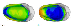 Biomechanics Abb. 47: Mittelwert (a) aller 15 Patellae und Standardabweichung (b). Ansicht der linken Patellagelenkfläche.