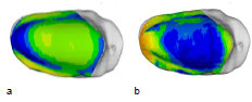 Biomechanics Abb. 48: Mittelwert (a) aller 12 Patellae über 15 kg und Standardabweichung (b). Ansicht der linken Patellagelenkfläche.