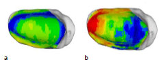 Biomechanics Abb. 49: Mittelwert (a) aller 5 männlichen Patellae und Standardabweichung (b). Ansicht der linken Patellagelenkfläche.