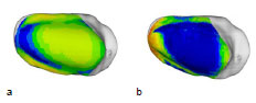 Biomechanics Abb. 50: Mittelwert (a) aller 10 weiblichen Patellae und Standardabweichung (b). Ansicht der linken Patellagelenkfläche.