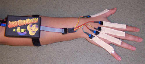 Flex Sensor Figure 1 - Prototype of the sensor glove monitor. - The monitor is shown with five sensors placed on the MCP joints. Signal conditioning is contained in the box. The next prototype will include a wireless link for data download to an external computer, enabling the removal of the cable extending out of the back of the box.