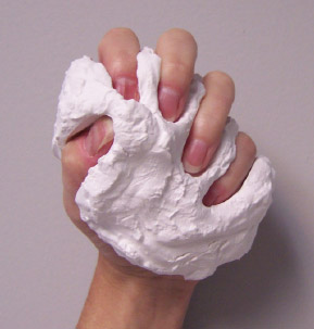 Flex Sensor Figure 4 - Grip mold. - The grip mold is custom made for each subject. It provides a repeatable position for the fingers to assume for multiple grip-release activities in order to evaluate repeatability of measurement.