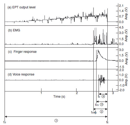 Flex Sensor Figure 1 Records of output level, EMG, finger and voice responses during EPT (tS: start time, tE: end time, tEMG, tFS, tV: EMG, finger and voice response start time, 1 : total EPT stimulus time, 2 – 4 : measured excessive stimulus time according to EMG, finger and voice response, respectively).