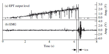 Flex Sensor Figure 2 Control of electric pulp tester’s output using EMG response (tCB: time delay between EMG response start time and EPT circuit break).