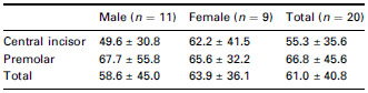 Flex Sensor Table 2 Time delay (mean ± SD, ms) between EPT output termination and onset of EMG