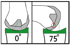 Biomechanics Figure 2-4: Schematic demonstrating the cam-spine function of PCL-substituting designs. At full extension the cam-spine provide anterior constraint of femoral component. As the knee flexes cam-spine interaction (red circle) help to drive the femur posterior and induce femoral “rollback”.
