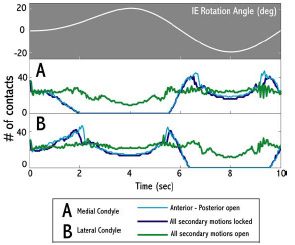 Biomechanics Figure 3-10: The number of medial and lateral condyle tibiofemoral contact points during rotational constraint simulations for three different locking configurations. Simulations with all secondary motions locked and with only anterior-posterior motion allowed produced periods of condylar unloading.