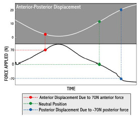 Biomechanics Figure 4-3: Cubic spline interpolations were fit to anterior-posterior displacement and force curves. Anterior and posterior laxity measures were determined by finding the AP displacement that corresponded with ±70 N AP force. Neutral point was similarly found from the displacement at 0 N force.