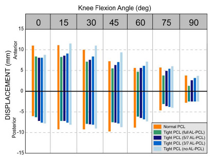 Biomechanics Figure 4-6: Partial release of a tight anterolateral PCL bundle increased anterior and posterior displacement at nearly all flexion angles with a condylar insert. Zero on the y-axis refers to neutral point for that simulation only.