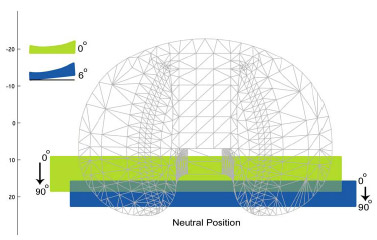 Biomechanics Figure 4-8: Schematic demonstrating neutral position differences between 0º and 6º posterior tibial slope. A 6º tibial slope reduced the overall travel of the neutral position as compared to the 0º slope condition, and it also placed the neutral point near the posterior edge of insert at 90º.