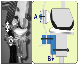 Biomechanics Figure 5-2: The mechanical TKR model allowed the patellar height to be reduced through shortening patellar tendon length by moving A superior and inferior (patella baja). It also could be adjusted by moving the tibial tubercle (B) superior and inferior (pseudo patella baja).