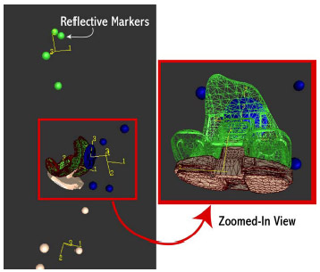 Biomechanics Figure 5-4: Software for Interactive Musculoskeletal Modeling (SIMM) screenshot of dynamic knee simulator. This model allowed visualization of computer assisted design (CAD) total knee replacement components shortly after experimentation.
