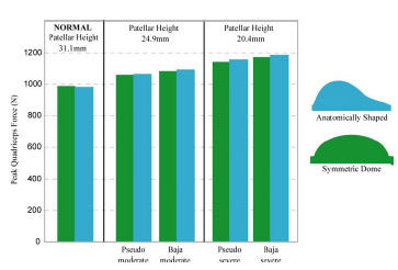 Biomechanics Figure 5-5: Bar graph depicting peak quadriceps tension (N) for a mechanical knee model undergoing extension with different patellar heights.