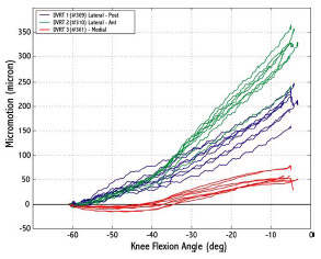 Biomechanics Figure 6-5: Differential variable reluctance transducer recordings were repeatable between trials. All recordings start from 0 because the reading at peak quadriceps force was used as a baseline.