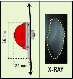Biomechanics Figure C-1: LEFT - Schematic demonstrating the dimensions of patellar component. Patella was designed with a 24 mm width and 36 mm length. These values match literature values. RIGHT – Sagittal x-ray of a typical patella.