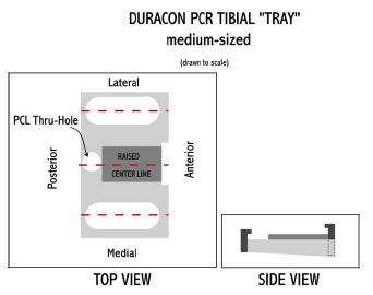 Biomechanics Figure C-4: : Schematic illustrating the design of tibial “tray” for a Duracon CR insert. A 3º posterior slope was designed into the tray. A PCL thru-hole allowed the climbing rope to be passed thru the tibial tray. Two slotted holes allowed the anterior-posterior placement of the tibial insert to be adjusted.