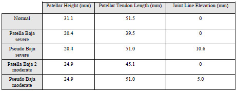 Biomechanics Table 5-1: Patellar height, patellar tendon length, and joint line elevation values were computed for each experimental condition.