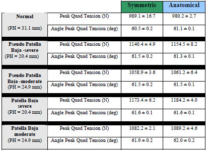 Biomechanics Table 5-2: Peak quadriceps tension (N) and the angle of peak tension (deg) is given for all patellar height conditions and both patellar designs.