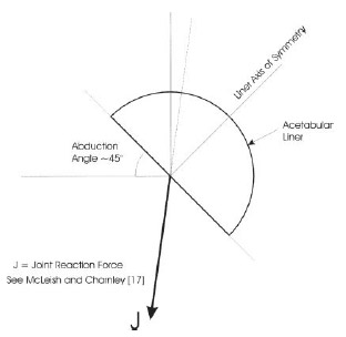 Figure 1. Joint reaction force diagram. Figure 1. Joint reaction force diagram.