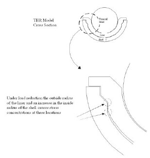 Figure 11. Location of stress concentrations under tolerance stack adverse case dimensions. Figure 11. Location of stress concentrations under tolerance stack adverse case dimensions.