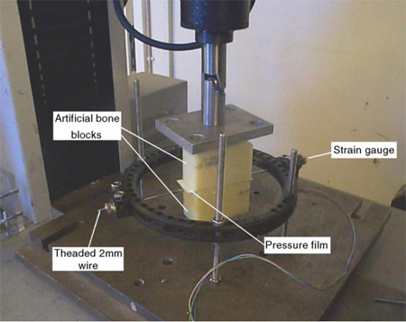 Fig. 1. The experimental model showing the threaded wire and strain
gauge load cell. The pressure film can be seen between the two bone
blocks. experimental model