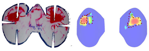 Contacts determined using Fuji film and the contact determination algorithm Fig. 1. Contacts determined using Fuji film and the contact determination algorithm