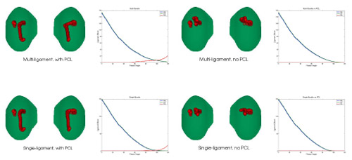 Contact paths and ligament profile of different ligament configurations: (a) multi-bundle ligament, (b) multi-bundle without PCL, (c) single-bundle ligament, (d) single-bundle without PCL Fig. 5. Contact paths and ligament profile of different ligament configurations: (a) multi-bundle ligament, (b) multi-bundle without PCL, (c) single-bundle ligament, (d) single-bundle without PCL