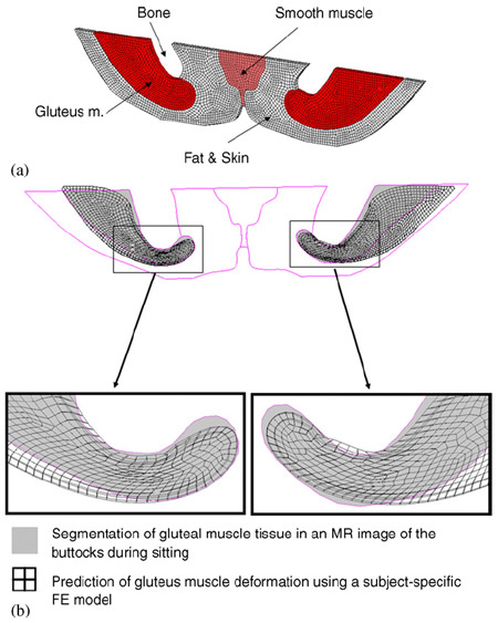 Fig. 3. Mesh of the three-dimensional subject-specific FE model (for subject #4, Table 1) (a), and an example of the fit between MRImeasured (gray areas) and FE-calculated (meshed areas) gluteal muscle contours during weight-bearing sitting (b). The right and left frames show data for the gluteus muscles at the right and left body sides, respectively. figure-3