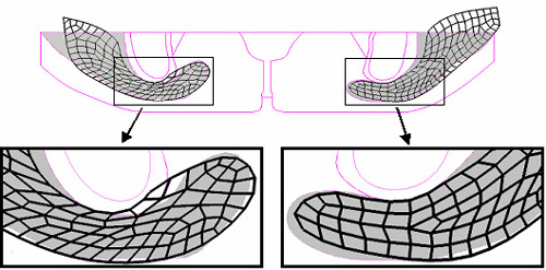 Segmentation of gluteal muscle tissue in an MR image of the buttocks during sitting
Prediction of gluteus muscle deformation using a subject-specific FE model