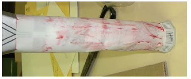 Figure 18. Developed pressure film attached to racquet handle figure 18