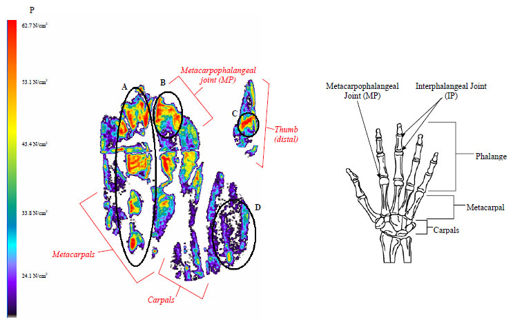 Figure 19. Pressure film results for a forehand stroke for the metacarpals and thumb figure 19