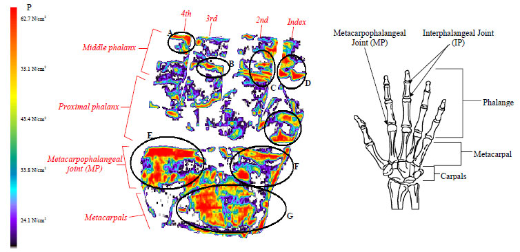 Figure 20. Pressure film results for a forehand stroke for the MP joint and phalanges figure 20