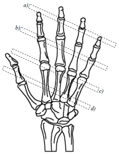 Figure 22. Location of cantilever beams with respect to the gripping hand for a)distal phalanx; b)
proximal phalanx; c) MP joints and distal metacarpals; d) metacarpals figure 22