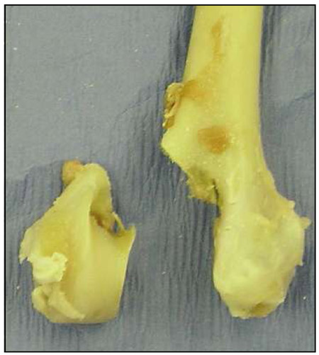 Fig. 1 Lateral condylar fracture model using the right humerus. fig 1