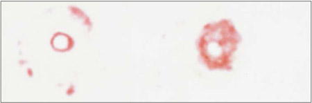 Fig. 2 Scanned image of Pressurex film after compression. fig 2
