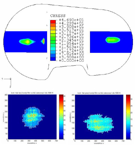 Fig. 5 – Comparison of contact pressure results: F=1000 N fig 5