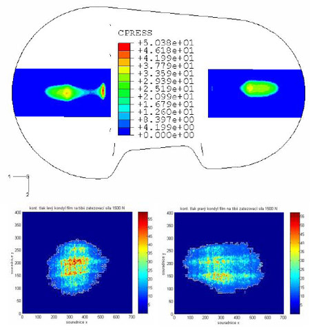 Fig. 6 – Comparison of contact pressure results: F=1500 N fig 6