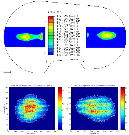 Fig. 8 – Comparison of contact pressure results: F=2500 N fig 8