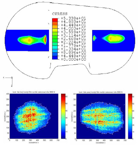 Fig. 9 – Comparison of contact pressure results: F=3000 N fig 9