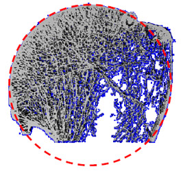 Biomechanics Figure 5 Humeral head radius of curvature.